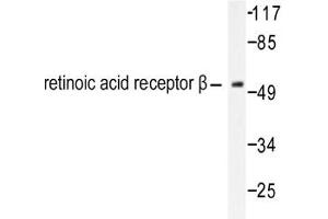 Image no. 1 for anti-Retinoic Acid Receptor, beta (RARB) antibody (ABIN271806)
