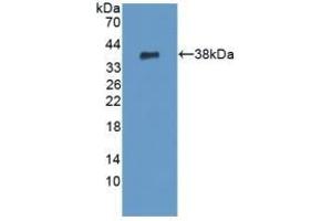 Detection of Recombinant PADI6, Human using Polyclonal Antibody to Peptidyl Arginine Deiminase Type VI (PADI6) (PADI6 antibody  (AA 393-694))