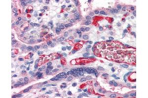 Anti-Fibrinogen antibody IHC of human placenta. (Fibrinogen antibody  (FITC))