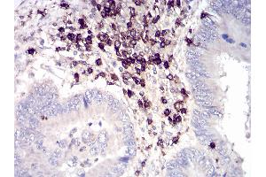 Immunohistochemistry (IHC) image for anti-CD6 (CD6) (AA 18-199) antibody (ABIN5542301)