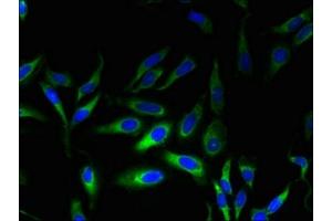 Immunofluorescent analysis of Hela cells using ABIN7165827 at dilution of 1:100 and Alexa Fluor 488-congugated AffiniPure Goat Anti-Rabbit IgG(H+L) (MPV17 antibody  (AA 1-176))