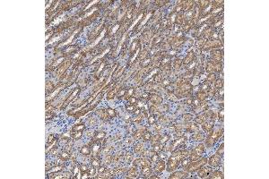 IHC analysis of SHQ1 using anti-SHQ1 antibody (ABIN7599205). (SHQ1 antibody  (AA 1-277))