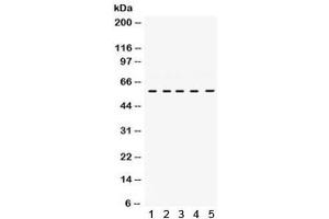 Western blot testing of human 1) HUT, 2) Jurkat, 3) Raji, 4) CEM and 5) K562 cell lysate with LCK antibody. (LCK antibody)