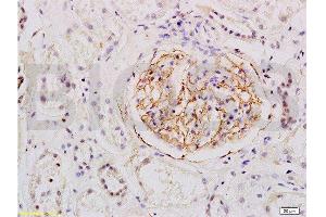 Formalin-fixed and human kidney tissue labeled with Anti-ESM1 Polyclonal Antibody, Unconjugated  at 1:200 followed by conjugation to the secondary antibody and DAB staining (ESM1 antibody  (AA 51-150))