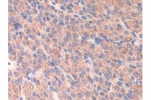 Detection of ATF7 in Mouse Ovary Tissue using Polyclonal Antibody to Activating Transcription Factor 7 (ATF7) (ATF7 antibody  (AA 50-270))