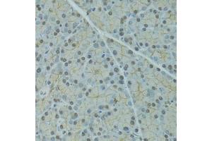 Immunohistochemistry of paraffin-embedded rat pancreas using SERPINF2 antibody  at dilution of 1:100 (40x lens). (alpha 2 Antiplasmin antibody  (AA 302-491))