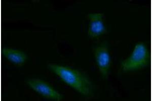 Immunofluorescence (IF) image for anti-T-cell surface glycoprotein CD1c (CD1C) antibody (ABIN2670669) (CD1c antibody)