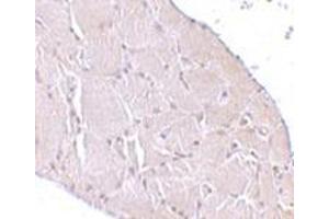 Immunohistochemistry of Wnt10a in human skeletal muscle tissue cells with this product at 10 μg/ml.
