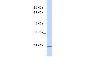 WB Suggested Anti-IFNA5 Antibody Titration: 0. (IFNA5 antibody  (Middle Region))