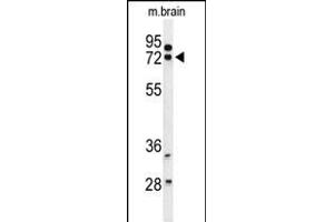 Western blot analysis of HSA Antibody (Center) (ABIN653722 and ABIN2843031) in mouse brain tissue lysates (35 μg/lane). (HSPA12A antibody  (AA 398-427))