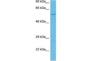 Host:  Mouse  Target Name:  TYRP1  Sample Tissue:  Mouse Liver  Antibody Dilution:  1ug/ml (Tyrosinase-Related Protein 1 antibody  (N-Term))