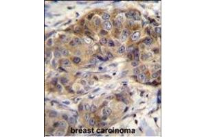 Immunohistochemistry (Paraffin-embedded Sections) (IHC (p)) image for anti-Glutathione Reductase (GSR) (AA 380-408), (C-Term) antibody (ABIN655985)