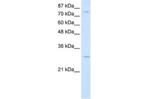 Western Blotting (WB) image for anti-RNA Binding Motif Protein 28 (RBM28) antibody (ABIN2462278) (RBM28 antibody)