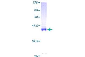 CNBP Protein (AA 1-170) (GST tag)