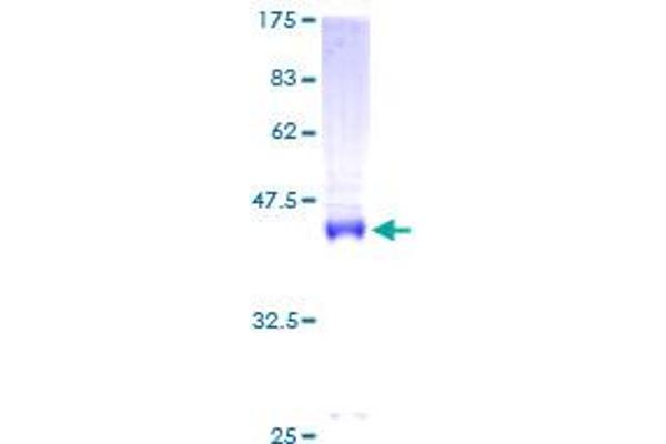 CNBP Protein (AA 1-170) (GST tag)