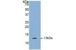 Detection of Recombinant tPA, Human using Polyclonal Antibody to Tissue Plasminogen Activator (tPA) (PLAT antibody)