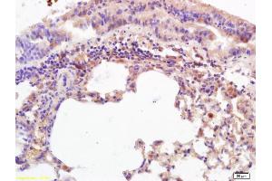 Formalin-fixed and paraffin embedded mouse lung labeled with Anti-MICA/MHC I a Polyclonal Antibody, Unconjugated (ABIN728788) at 1:200 followed by conjugation to the secondary antibody and DAB staining. (MICA antibody  (AA 120-170))