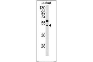 Western blot analysis of GNAT1 Antibody (C-term) in Jurkat cell line lysates (35ug/lane). (GNAT1 antibody  (C-Term))