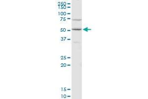 CDC14B polyclonal antibody (A01), Lot # 06046. (CDC14B antibody  (AA 360-459))