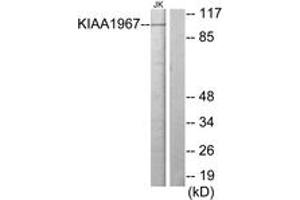 Western Blotting (WB) image for anti-Cell Cycle and Apoptosis Regulator 2 (CCAR2) (AA 431-480) antibody (ABIN2889671) (CCAR2 antibody  (AA 431-480))