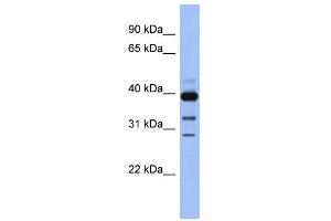 WB Suggested Anti-GNAO1 Antibody Titration: 0. (GNAO1 antibody  (N-Term))