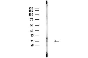 Western blot analysis of lysates from PC12 cells(starvation,24h treatment), using MT-ATP6 Antibody at 1/1000 dilution.
