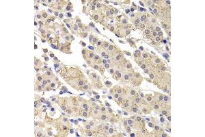 Immunohistochemistry of paraffin-embedded human stomach using DFFA antibody at dilution of 1:100 (x400 lens). (DFFA antibody)