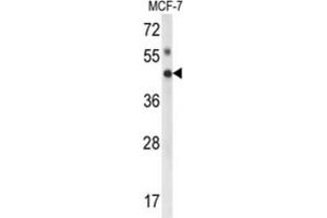 Western Blotting (WB) image for anti-Inositol Polyphosphate Multikinase (IPMK) antibody (ABIN3003997) (IPMK antibody)