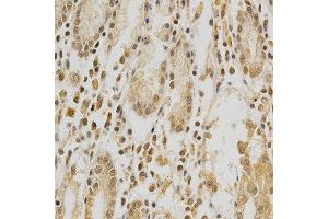 Immunohistochemistry of paraffin-embedded human stomach using HDAC6 antibody at dilution of 1:200 (x400 lens) (HDAC6 antibody  (AA 1-200))