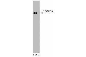 Western blot analysis of Phospholipase Cbeta4 on a rat pituitary lysate (left). (Phospholipase C beta 4 antibody  (AA 752-961))