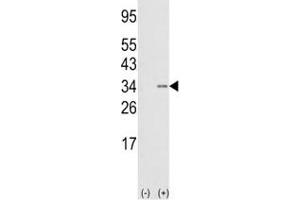 Western Blotting (WB) image for anti-SNAIL (SNAI1) (AA 9-39) antibody (ABIN3032657)