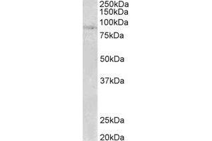 Western Blotting (WB) image for anti-SET Domain, Bifurcated 2 (SETDB2) (N-Term) antibody (ABIN2465045)