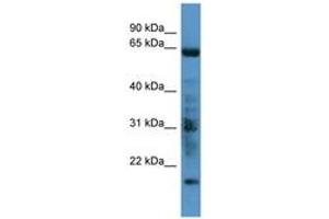 Image no. 1 for anti-G Protein-Coupled Receptor Kinase 7 (GRK7) (C-Term) antibody (ABIN6746684) (GRK7 antibody  (C-Term))