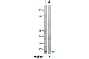 Western blot analysis of extracts from COS-7 cells, using MRPS21 polyclonal antibody .
