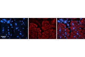 Rabbit Anti-AKAP7 Antibody    Formalin Fixed Paraffin Embedded Tissue: Human Adult heart  Observed Staining: Membrane, Cytoplasmic Primary Antibody Concentration: 1:600 Secondary Antibody: Donkey anti-Rabbit-Cy2/3 Secondary Antibody Concentration: 1:200 Magnification: 20X Exposure Time: 0. (AKAP7 antibody  (Middle Region))