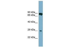WB Suggested Anti-CYB5D1 Antibody Titration: 0. (CYB5D1 antibody  (Middle Region))