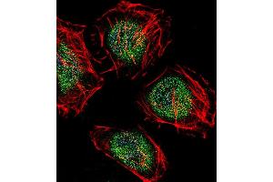 Fluorescent confocal image of Hela cell stained with CAF-1 Antibody (N-term) (ABIN655064 and ABIN2844694). (CNOT8 antibody  (N-Term))