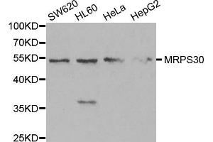 Western blot analysis of extracts of various cell lines, using MRPS30 antibody. (MRPS30 antibody)
