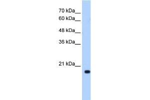 WB Suggested Anti-XTP3TPA Antibody Titration:  0. (DCTPP1 antibody  (N-Term))