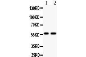 Anti- PIAS4 antibody, Western blotting All lanes: Anti PIAS4  at 0. (PIAS4 antibody  (C-Term))