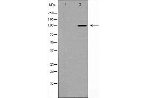 Western blot analysis of PSD95 expression in Brain (Rat) Tissue Lysate,The lane on the left is treated with the antigen-specific peptide. (DLG4 antibody  (C-Term))