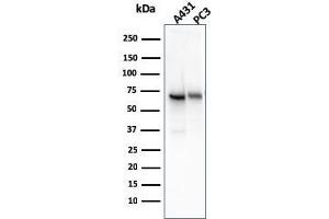 Western Blot Analysis of A431 and PC-3 cell lysate using CD73 Mouse Monoclonal Antibody (NT5E/2545). (CD73 antibody)