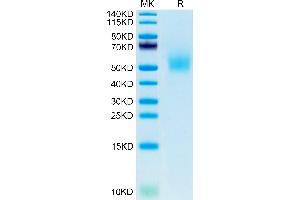 DLK1 Protein (AA 24-305) (His tag)