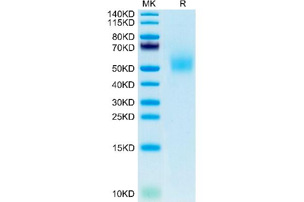 DLK1 Protein (AA 24-305) (His tag)