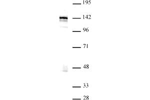 Western blot of BRD8 / SMAP2 antibody. (BRD8 antibody  (N-Term))