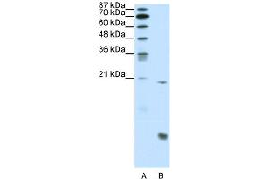 WB Suggested Anti-RUNX1 Antibody Titration:  0. (RUNX1 antibody  (N-Term))