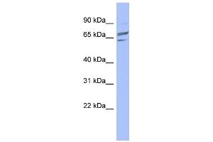 WB Suggested Anti-PGM1 Antibody Titration: 0. (Phosphoglucomutase 1 antibody  (Middle Region))