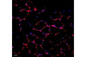 Immunofluorescence of paraffin embedded mouse Skeletal muscle using SMYD2 (ABIN7075581) at dilution of 1:1000 (400x lens) (SMYD2A antibody)