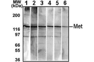 Western Blotting (WB) image for anti-Met Proto-Oncogene (MET) antibody (ABIN2995275)
