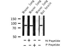 Western blot analysis of Phospho-IKK beta (Tyr199) expression in various lysates (IKBKB antibody  (pTyr199))